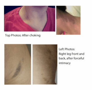 photos showing abuse